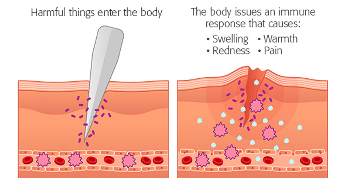 Close-up of inflamed, reactive skin showing redness and irritation